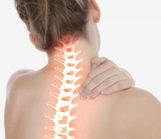 Gimdos kaklelio osteochondrozė