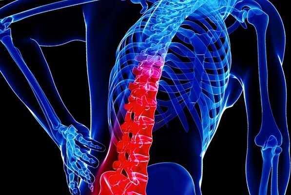 Krūtinės ląstos osteochondrozės vystymosi priežastys