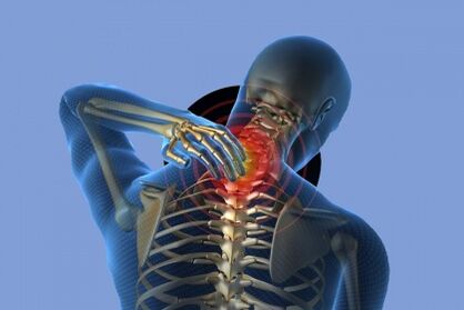 Kaklo skausmas su osteochondroze