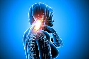 Osteochondrozė gimdos kaklelio stubure