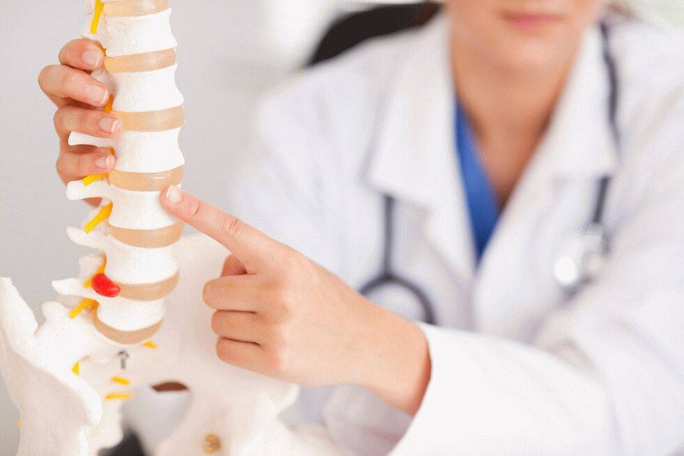 Gydytojas apie osteochondrozę ir jos prevenciją